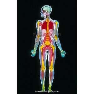  Coloured MRI whole body scan of a man Framed Prints