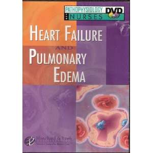  Heart Failure & Pulmonary Edema   Pathophysiology for 