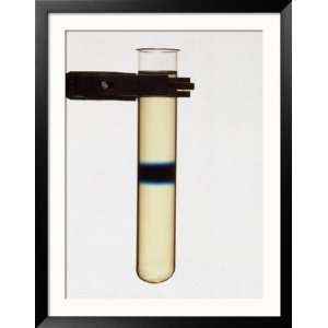  Agar with Methylene Blue Layer Between Framed Photographic 