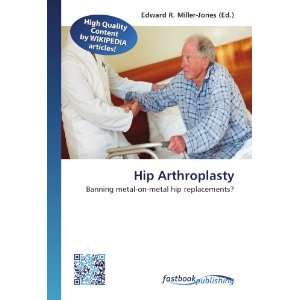  Hip Arthroplasty Banning metal on metal hip replacements 